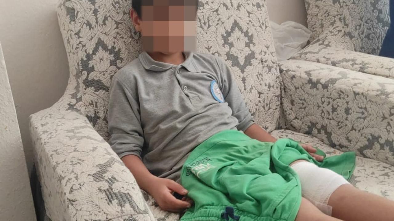 Bursa’da Okul Yolunda Köpek Saldırısı Gerçekleşti Bursa’da Okul Yolunda Köpek Saldırısı Gerçekleşti